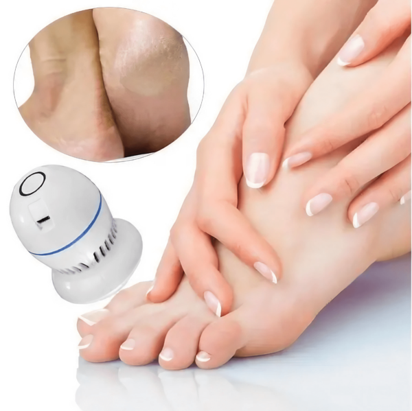 SmoothStep™ Electric Dead Skin Remover - Image 5