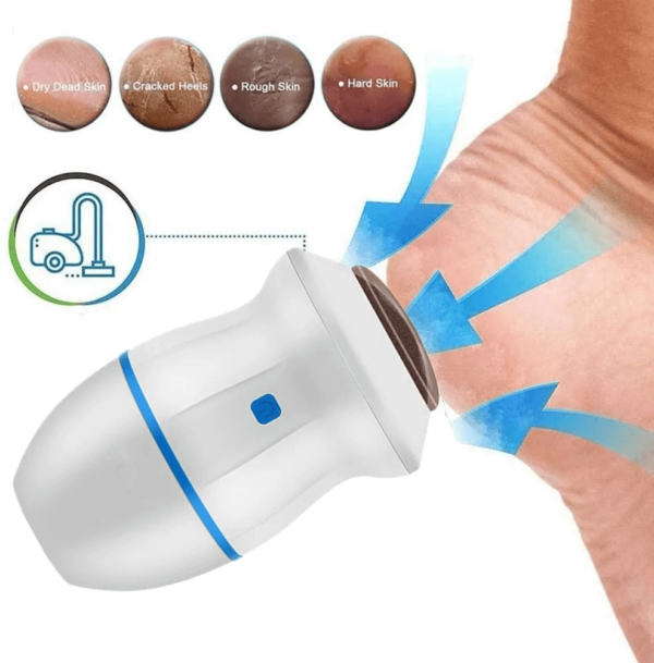 SmoothStep™ Electric Dead Skin Remover - Image 3