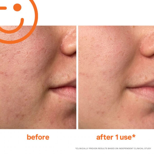 Kate Somerville ExfoliKate™ Intensive Exfoliating Treatment - Image 2