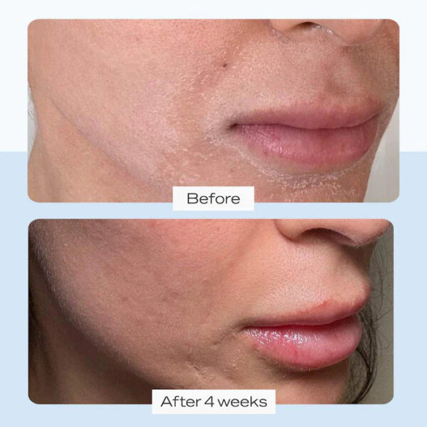 Ultra Repair® Cream Intense Hydration - Image 2