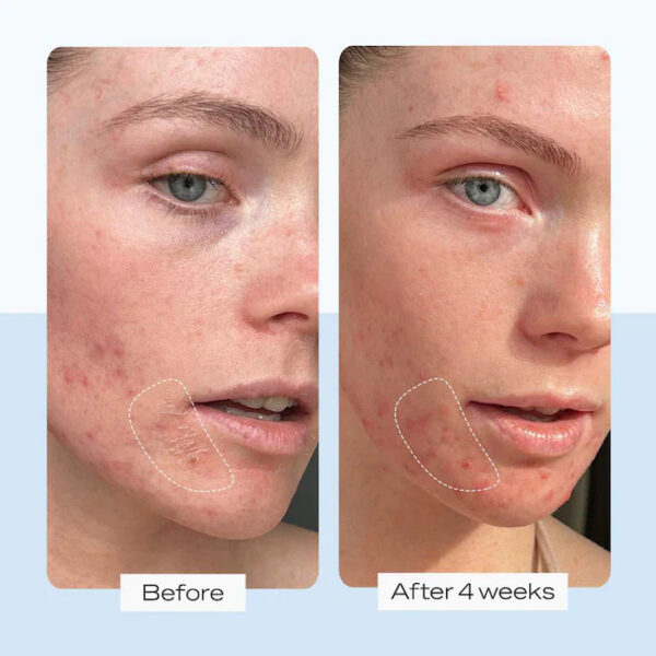 Ultra Repair® Cream Intense Hydration - Image 9