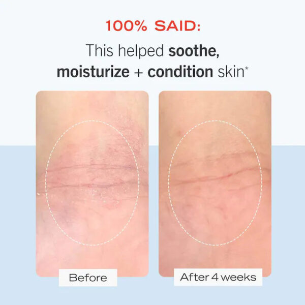 Ultra Repair® Cream Intense Hydration - Image 4