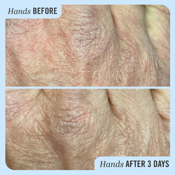 Ultra Repair® Cream Intense Hydration - Image 10