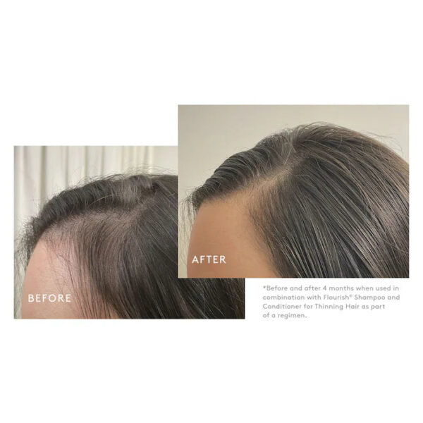 Flourish® Density Booster for Healthy Hair Growth - Image 5