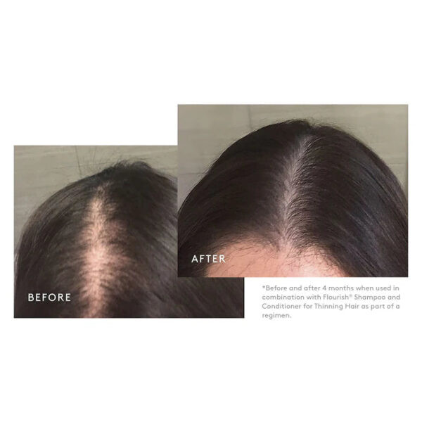 Flourish® Minoxidil 5% Hair Growth Treatment - Image 2