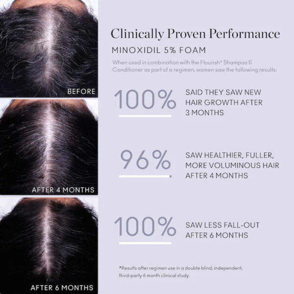 Flourish® Minoxidil 5% Hair Growth Treatment - Image 4