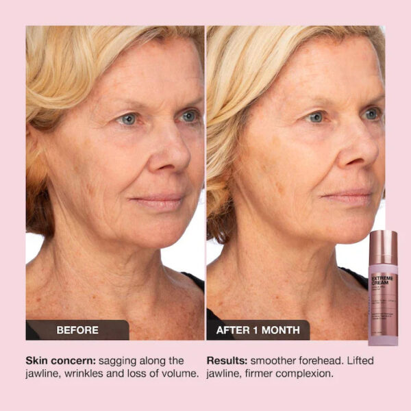 Extreme Cream Anti-Aging, Firming, & Lifting Refillable Moisturizer - Image 4